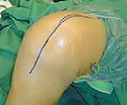 التخطيط ما قبل الجراحة والأشعة