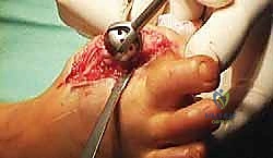 فحص سريري يوضح التشوه وقصر الإصبع