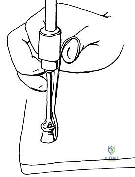 صورة توضيحية لـ اندماج مفصل إبهام القدم بتطعيم العظام: دليل شامل لاستعادة وظيفة القدم مع الأستاذ الدكتور محمد هطيف