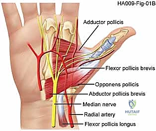 توضيح الأربطة المتضررة أثناء الخلع
