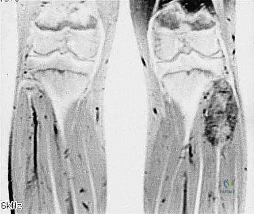 مرحلة التشخيص