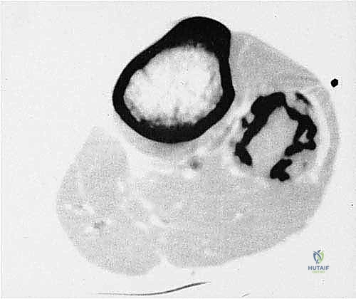 مرحلة التشخيص