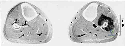 صورة جراحية