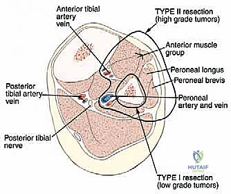 السيطرة الوعائية