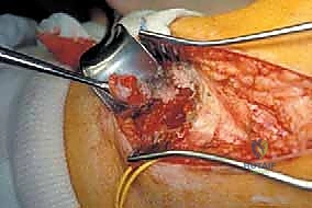 صورة توضيحية