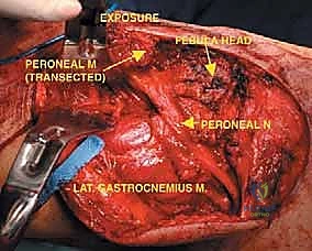 تخطيط جراحي