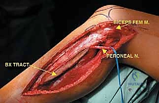 مرحلة التعافي