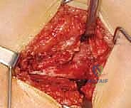 الفحص السريري الدقيق لتشخيص مشاكل الورك