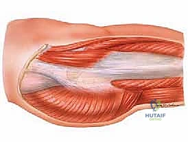 مركب العضلة الحرقفية القطنية