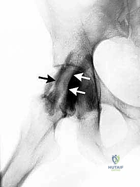التشخيص الدقيق بالموجات فوق الصوتية