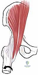 الأسباب الميكانيكية الحيوية لمتلازمة الورك الطاطئ