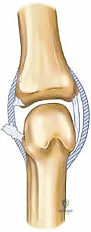 تشريح الأربطة الجانبية للإبهام