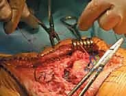 التخطيط الجراحي الدقيق قبل العملية