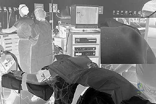 صورة توضيحية لـ متلازمة الكتف الطرقعي: دليل شامل للعلاج والتعافي مع الأستاذ الدكتور محمد هطيف