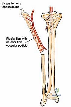 مرحلة التحضير المجهري للأوعية الدموية