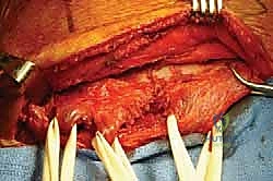 مراحل تقييم شلل الكتف