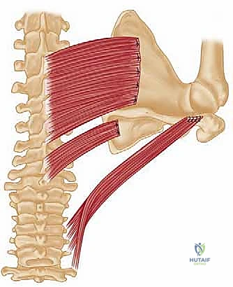 صورة شعاعية للتثبيت بخطاطيف العظام