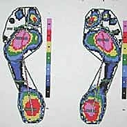 صورة طبية: كسور العظم السمسمي لإبهام القدم: دليل شامل للتثبيت الداخلي الدقيق مع الأستاذ الدكتور محمد هطيف