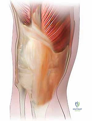 الفحص الشامل لاستبعاد الالتهابات والاختلالات الميكانيكية