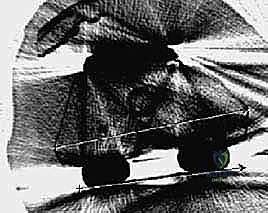 إزالة المكونات السابقة والأسمنت العظمي بأقصى درجات الحذر