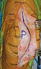 استخدام أحدث التقنيات الجراحية والمناظير في علاج المفاصل