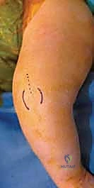 الأستاذ الدكتور محمد هطيف - أفضل جراح عظام أطفال في صنعاء