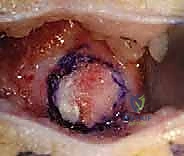 التقييم السريري والإشعاعي للركبة