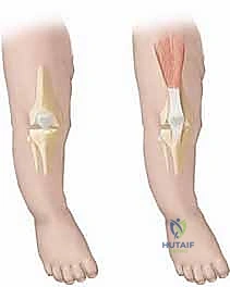 تحضير الطفل للعملية الجراحية