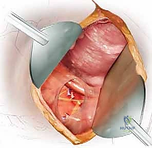 تجهيز المريض في غرفة العمليات بأعلى معايير التعقيم والتكنولوجيا