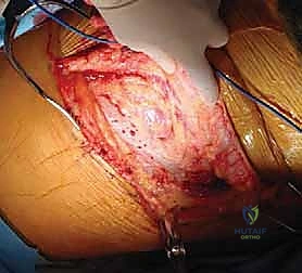 صورة توضح الرؤية الواسعة والآمنة التي يوفرها المدخل الأمامي