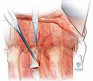 مناقشة خطة العلاج مع المريض وتوضيح الخيارات المتاحة بكل شفافية