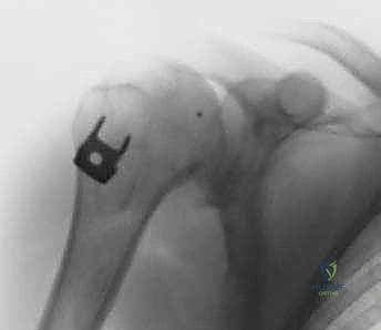 مناقشة نتائج الرنين المغناطيسي مع المريض