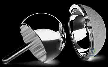 تآكل الغضاريف المفصلية