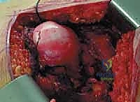 فحص سريري لحركة المفصل