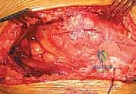 الأستاذ الدكتور محمد هطيف أثناء التقييم الطبي