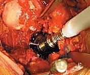 الأدوات الجراحية الدقيقة المستخدمة