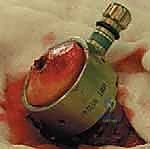 صورة طبية: استبدال سطح مفصل الورك: حل متطور لآلام الورك واستعادة النشاط مع الأستاذ الدكتور محمد هطيف