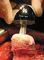 تحضير المريض في غرفة العمليات