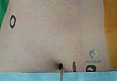 صورة طبية: استبدال سطح مفصل الورك: حل متطور لآلام الورك واستعادة النشاط مع الأستاذ الدكتور محمد هطيف