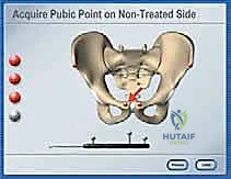 استخدام المبشرة الطبية للحوض