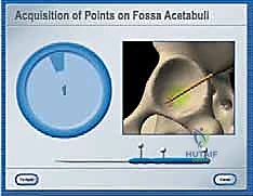 تجهيز المريض للعملية