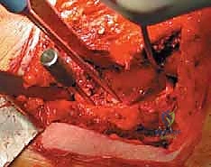 أحمد يمارس العلاج الطبيعي