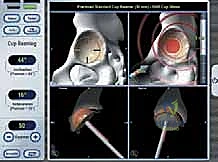 التحضير النهائي للرأس