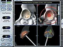 التأكد من التوافق الميكانيكي