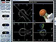 تجهيز السطح العظمي