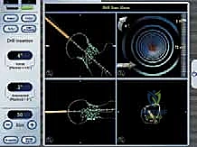 إغلاق الجرح بطريقة تجميلية