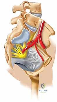 تخطيط الجراحة بناءً على الأشعة