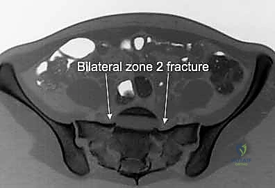 تجهيز المريض وتحديد المعالم التشريحية