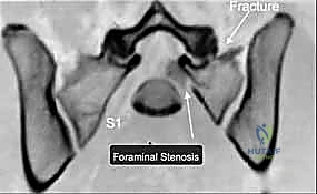 التخطيط الجراحي الدقيق