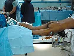 تقييم حالة المريض قبل التدخل